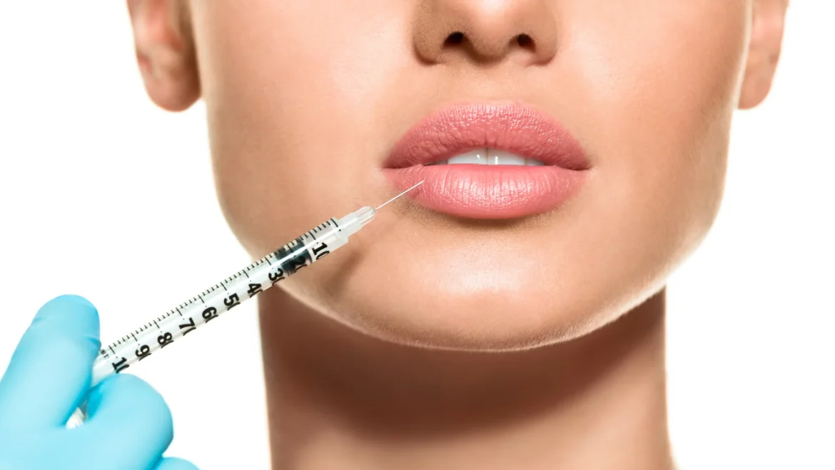 Lip augmentation filler benefits types and side effects